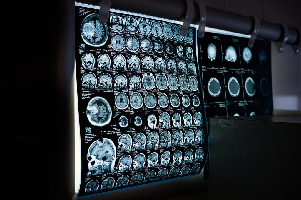 Hospital Estadual de Formosa amplia serviço de tomografia computadorizada em 2022